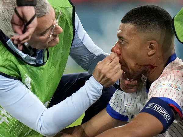 No surgery for Mbappé for now